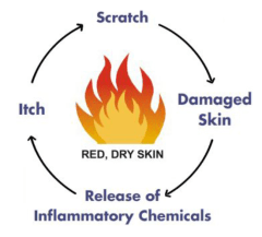 Itch Scratch Diagram Courtesy of the National Eczema Association